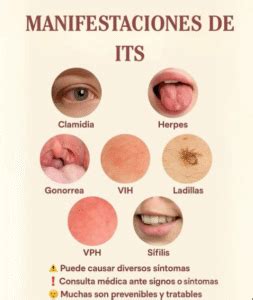 manifestaciones de  conociendo los sintomas comunes mas natural