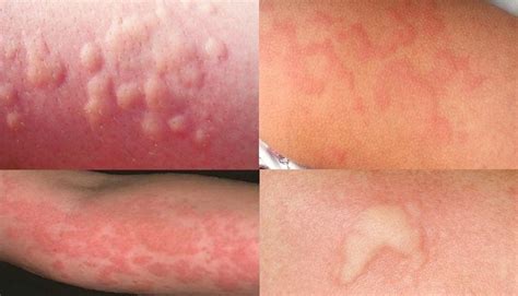 Dr.Nona produktų išskirtinumas – Halo kompleksas – Druskos.eu