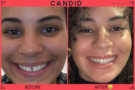 The forum candid io Transformation: Before & After Photos! - w4wdovj