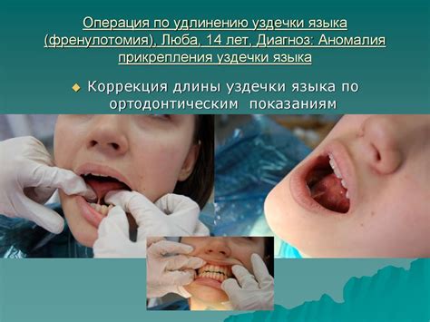 Амбулаторные операции в полости рта - презентация онлайн