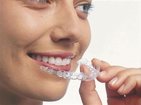 Invisible Braces Finance