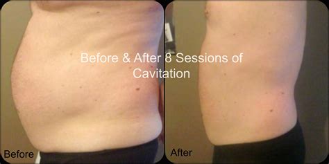 pin  lipo
