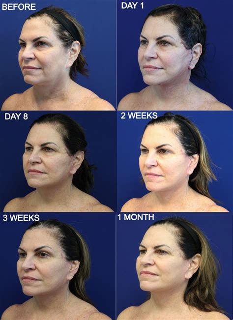 Feminization Activity