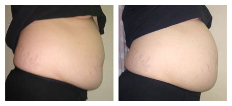 before/after breakfast, I have room for a lot more : r/Stuffers