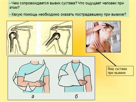 Презентация - Первая помощь при растяжении связок, вывихах суставов ...