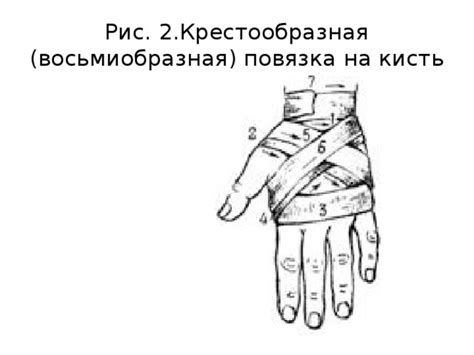 Презентация "Повязки на верхнюю конечность"