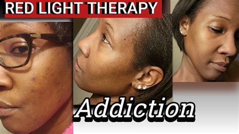 how long to use red light therapy on face