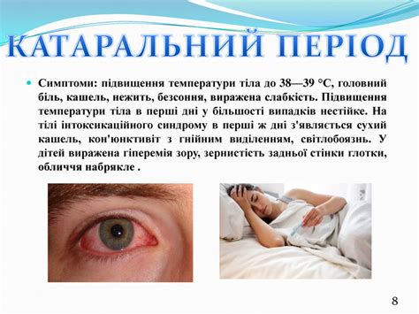 Презентація на тему: "Інфекційні захворювання: кір"