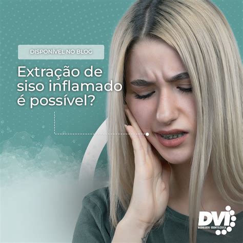 Siso Inflamado Pode Matar - O que fazer quando o siso está inflamado e precisa ser retirado?! | DVI ...