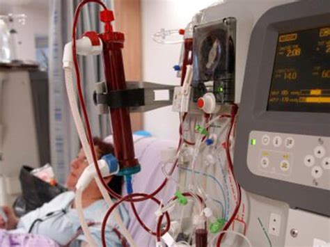 Гемодиализ - очищение крови при почечной недостаточности : Armedical