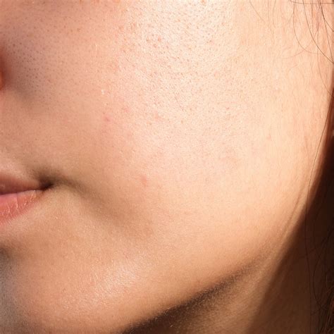 How to Repair Skin Barrier for Healthy and Glowing Skin