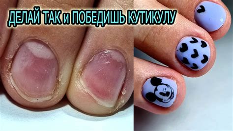 ЕСЛИ ТАК ДЕЛАТЬ то СПРАВИТЕСЬ с ВЛАЖНОЙ ЭЛАСТИЧНОЙ кутикулой КАЖДЫЙ ...
