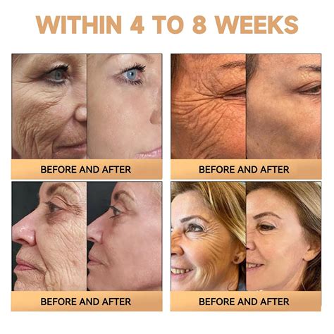 PLTOWE Super Anti-Aging Cream,2024 Latest Australia | Ubuy