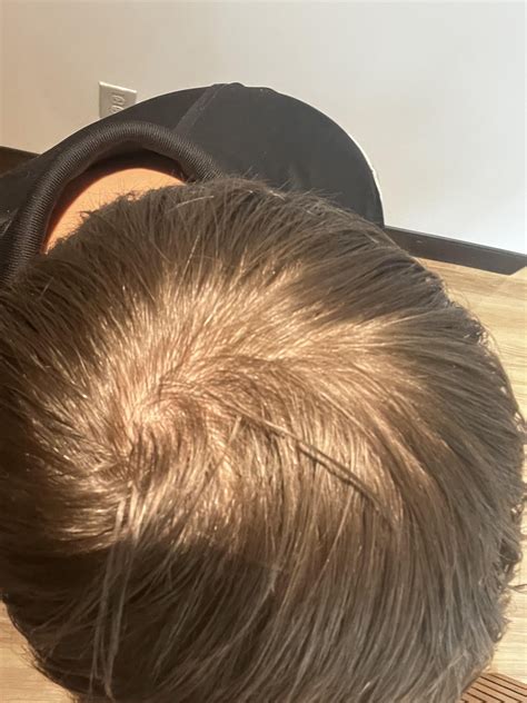 Is my hair thinning? : r/Hairloss