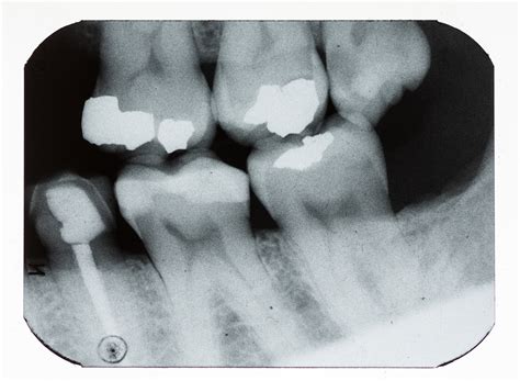 Thursday Troubleshooter: Dental practice liability and radiographs ...