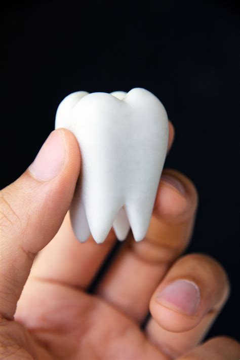 molars atenderdentalcare