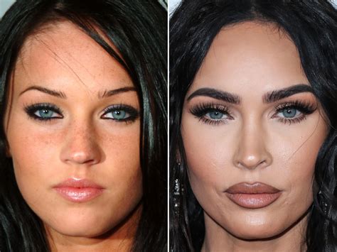 Megan Fox Before and After Plastic Surgery - The Skincare Secrets ...