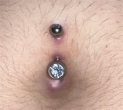 how to know if navel piercing is rejecting