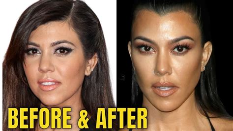 Kourtney Kardashian Nose Job Before And After