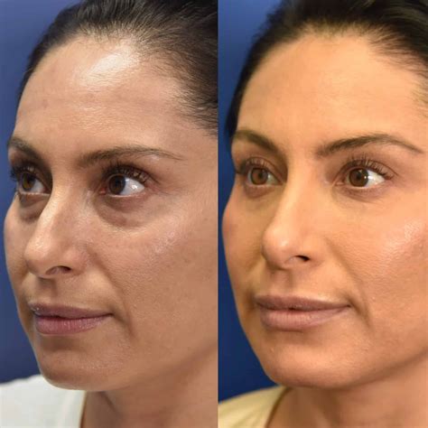 The InfluencerGoneWild Before & After That's Dividing The Internet Image 5