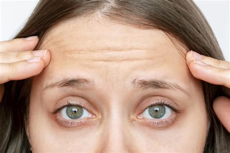forehead thread lift treatments  siam clinic phuket siam clinic