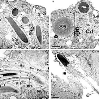 Late developing round spermatids and early elongating spermatids within ... 