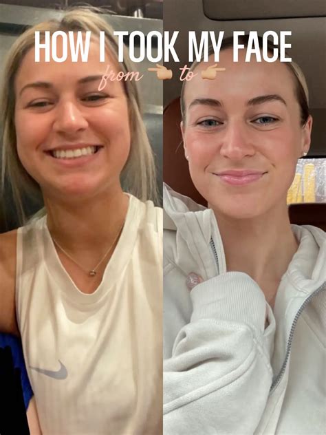 how i reduced my facial fluid retention 🙆🏼‍♀️ | Gallery posted by