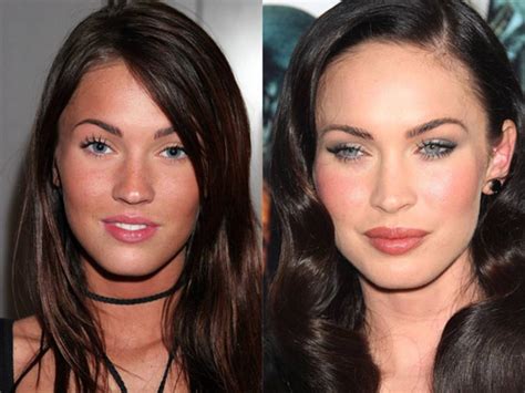 Megan Fox Before and After Plastic Surgery: A Tale of Evolution | ASEAN TV