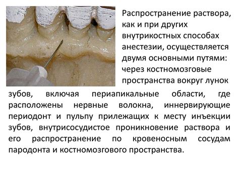 Местная анестезия в стоматологии - презентация онлайн