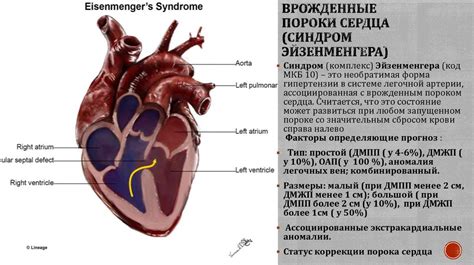 Легочная гипертензия: диагностика - презентация онлайн
