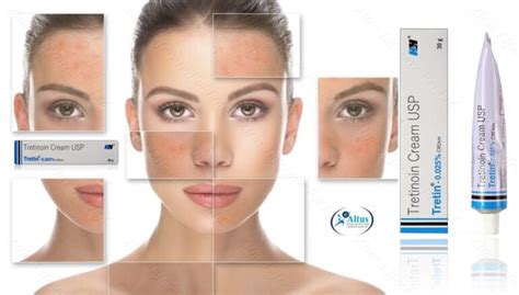 Erase Pimple Scars Like Magic! Discover the Ultimate Solution! 1