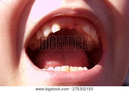 mouth  teeth image photo  trial bigstock
