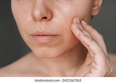 young caucasian woman greasy skin touching stock photo