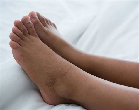 What is the difference between a wart, verruca, and papilloma