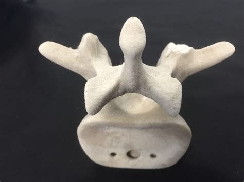 Lifelike 3D printed backbone replicas will prepare surgeons for spinal
