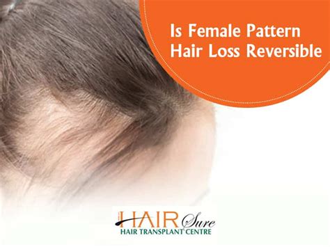 Is Female Pattern Hair Loss Reversible? - Cyber Hairsure