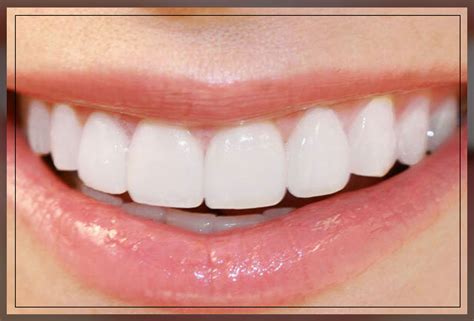 teeth shapes  treatments  correction dr amal al qedrah