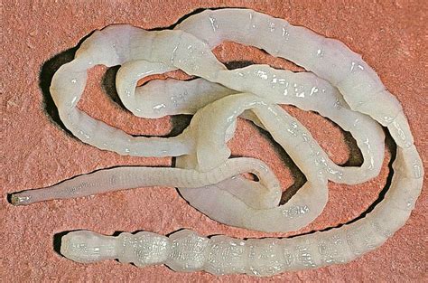 Pork Tapeworm In Humans: Symptoms And Treatment Of The Parasite ...