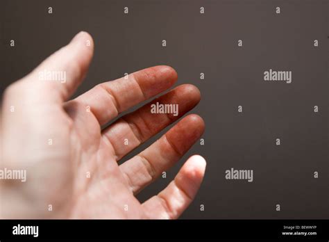 Cut Finger Blood Stock Photos & Cut Finger Blood Stock Images - Alamy