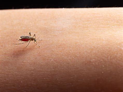 Stages Of Dengue Fever: Symptoms, Prevention & Management - Boldsky.com