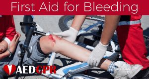 First Aid for Bleeding | How to Treat Bleeding | AEDCPR