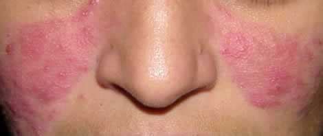 OPERATION SKINCARE
