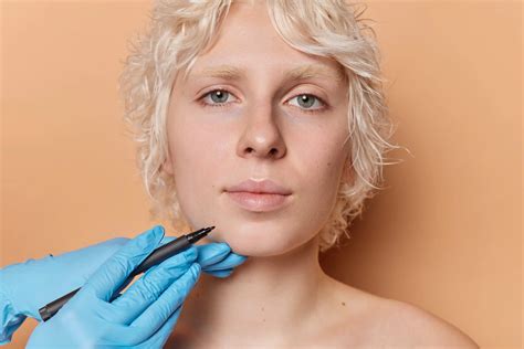 hair plug surgery cost 8