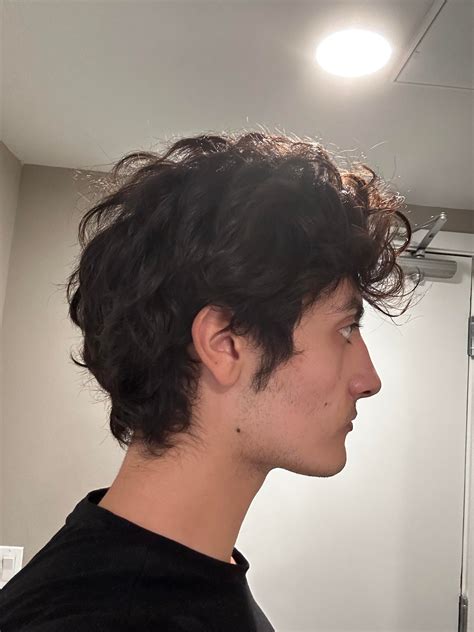 Deep Overbite. Need surgery? : r/jawsurgery