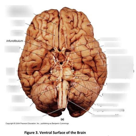 diagram  ventral surface  brain quizlet