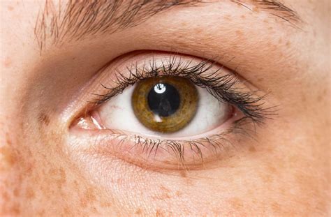 What Causes Dry Eyes with Contacts? | Stoney Creek Eye Care