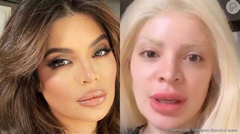 Antes E Depois Da Gkay - Antes e depois de Gkay: aparência é questionada e influencer reage ...