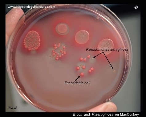 Escherichia coli and Pseudomonas aeruginosa colony appearance on ...