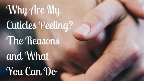 Why Are My Cuticles Peeling? The Reasons and What You Can Do