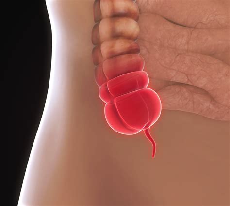 Abdominal Pain: Appendicitis - Revere Health